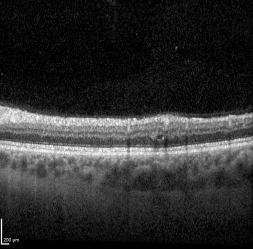 OCT research image; illustrative of the modality